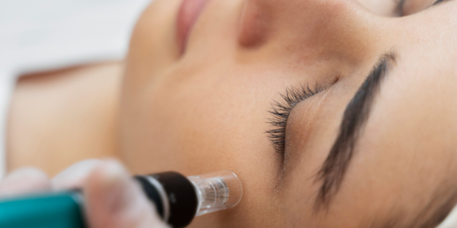 MESOPEEL- PEELING PROFESSIONAL SOLUTIONS: Immagine Header